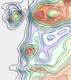 Stress