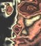 Metal